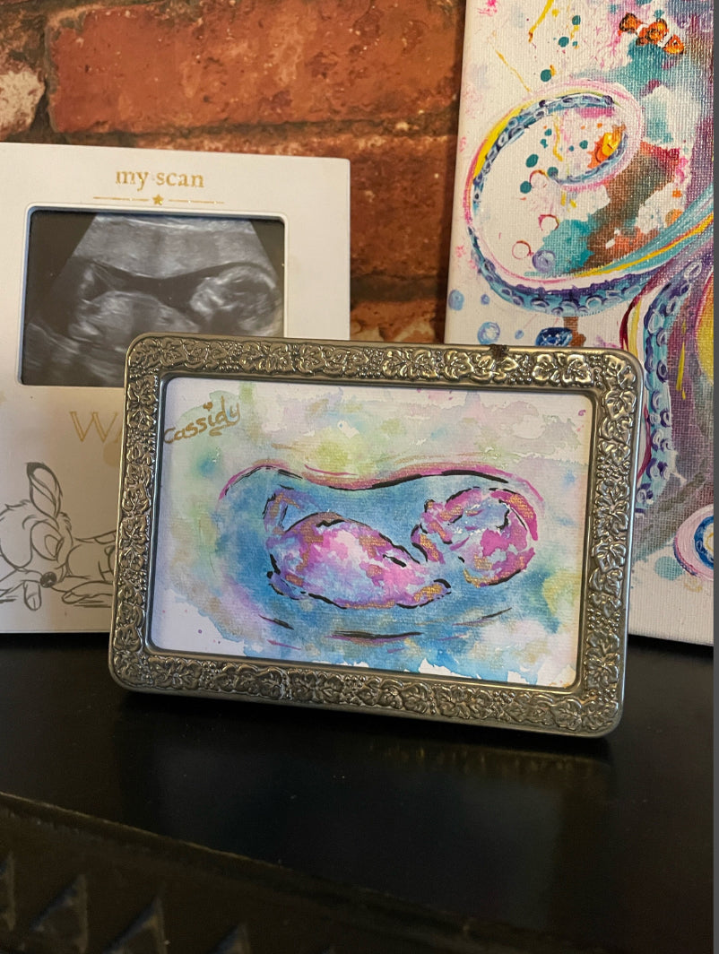 Baby Scan Personalised Watercolour Painting, Ultrasound Scan Art