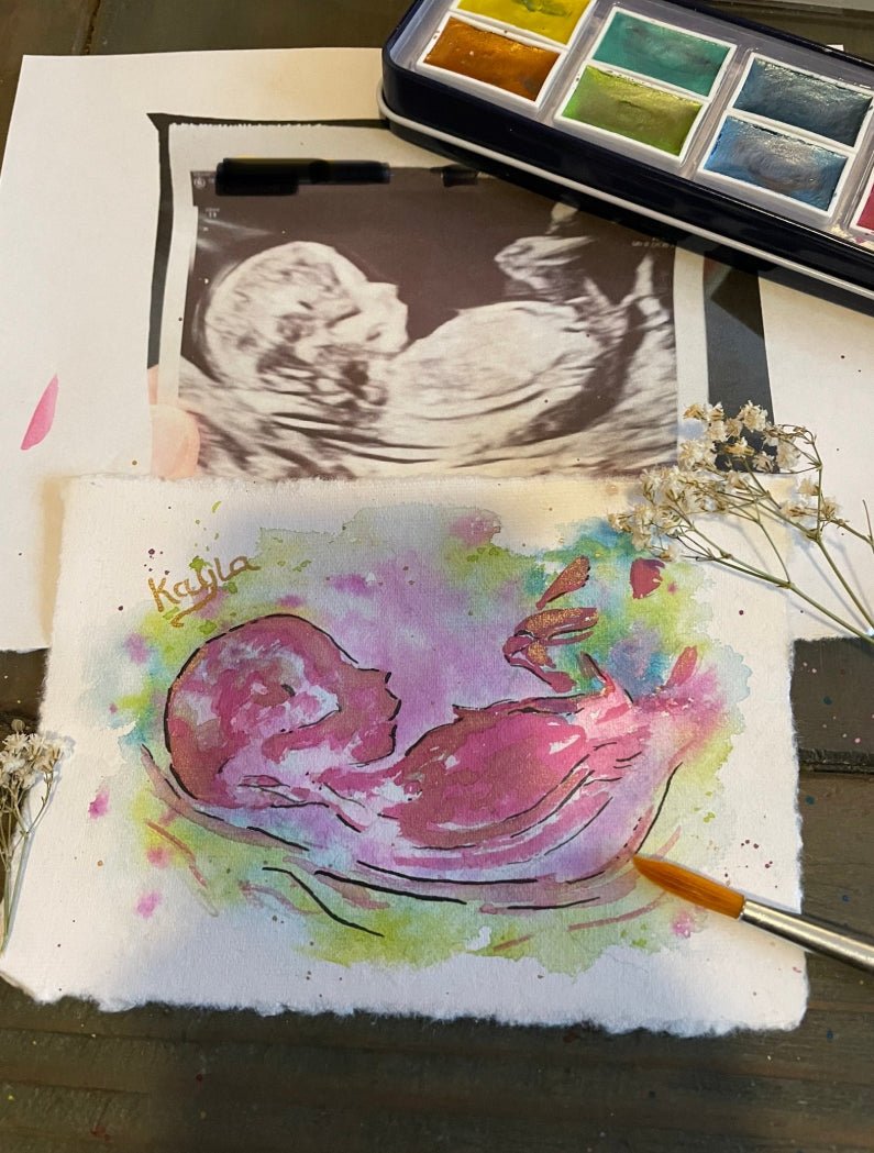Baby Scan Personalised Watercolour Painting, Ultrasound Scan Art-The Wild Fig &amp; Fern