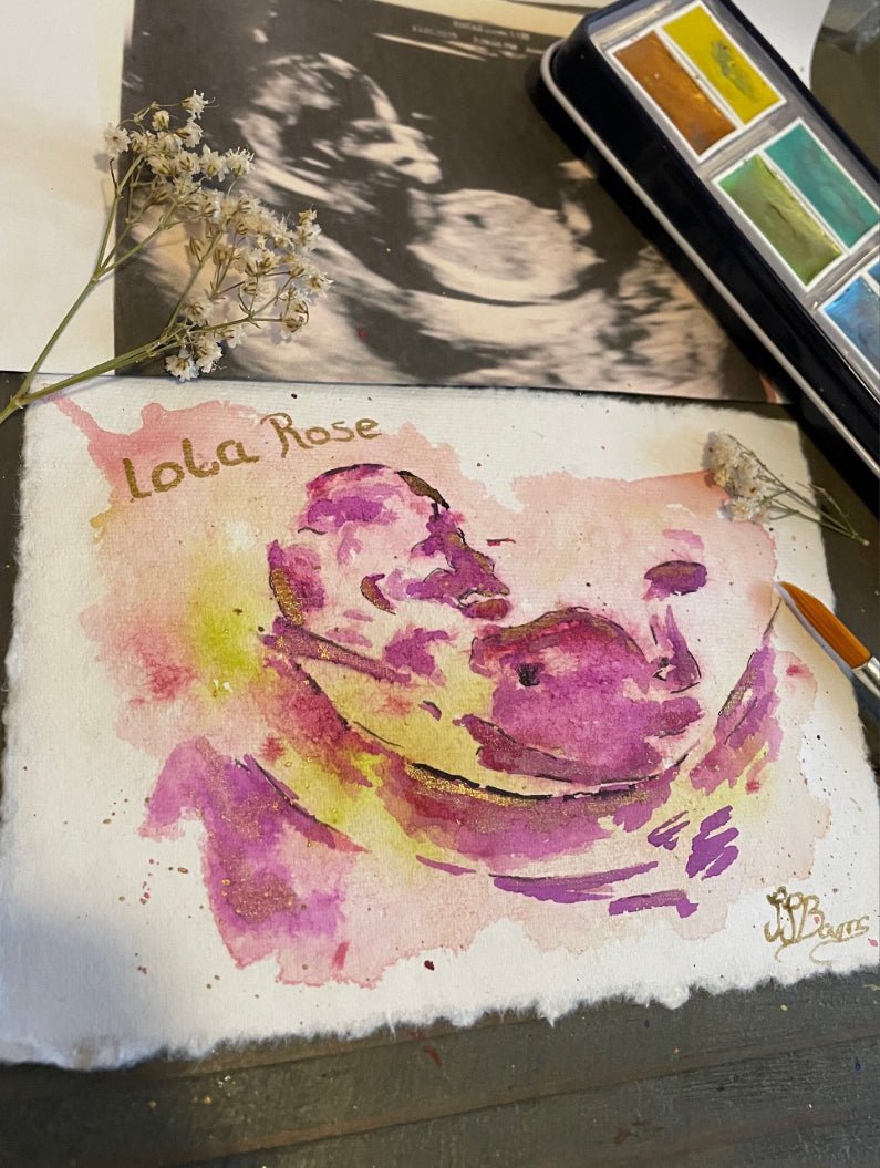 Baby Scan Personalised Watercolour Painting, Ultrasound Scan Art-The Wild Fig &amp; Fern