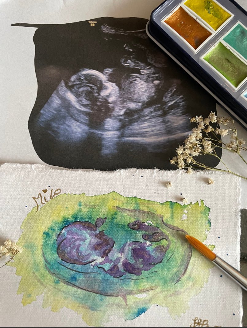 Baby Scan Personalised Watercolour Painting, Ultrasound Scan Art-The Wild Fig &amp; Fern