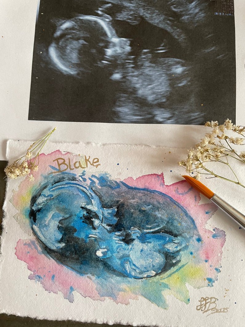 Baby Scan Personalised Watercolour Painting, Ultrasound Scan Art-The Wild Fig &amp; Fern