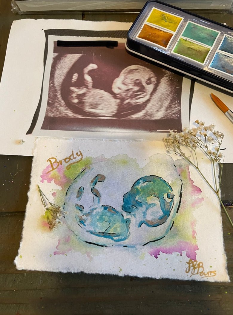 Baby Scan Personalised Watercolour Painting, Ultrasound Scan Art-The Wild Fig &amp; Fern